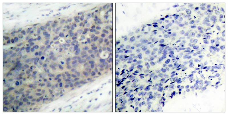 Anti-Phospho-LIMK2 (Thr505) Polyclonal Antibody