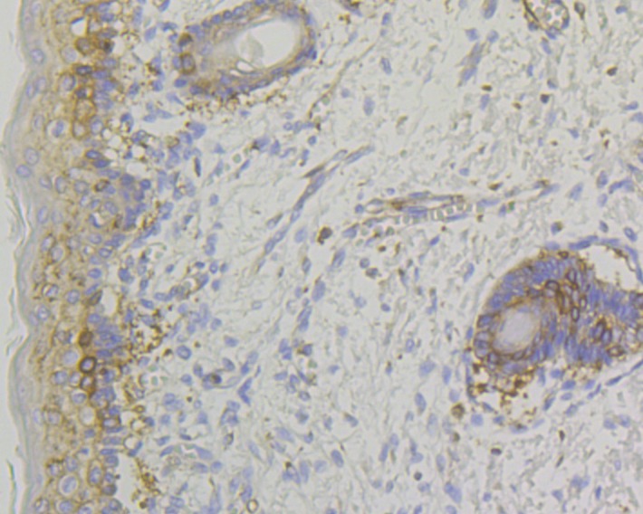 Anti-Lumican Antibody (9X464)