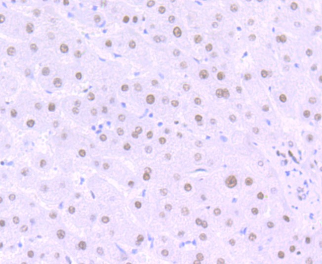 Anti-Matrin 3 Antibody (7P173)