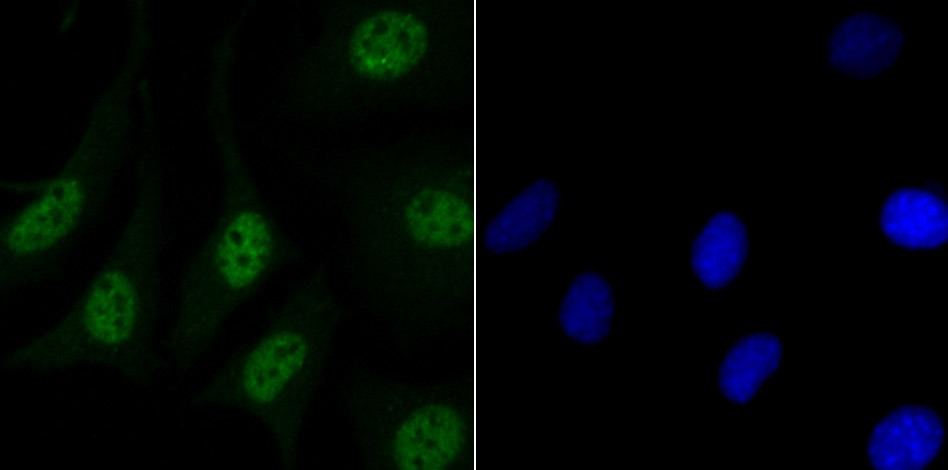 Anti-Matrin 3 Antibody (7P173)