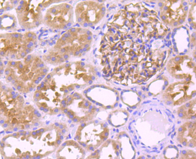 Anti-LEPR Antibody (5J993)