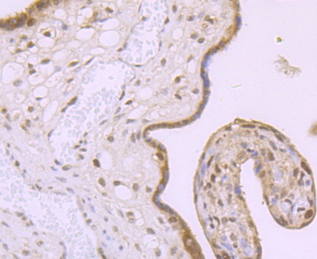 Anti-MBD3 Antibody (8O286)