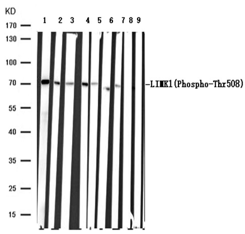 Anti-Phospho-LIMK1 (Thr508) Polyclonal Antibody