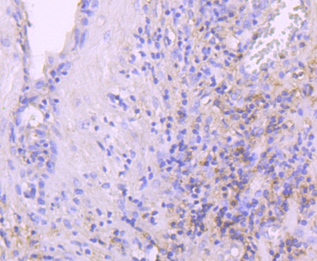 Anti-LEPR Antibody (5J993)