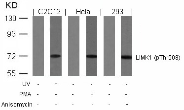 Anti-Phospho-LIMK1 (Thr508) Polyclonal Antibody