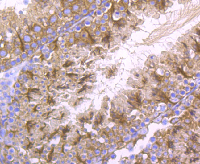 Anti-LOXL2 Antibody (5D796)