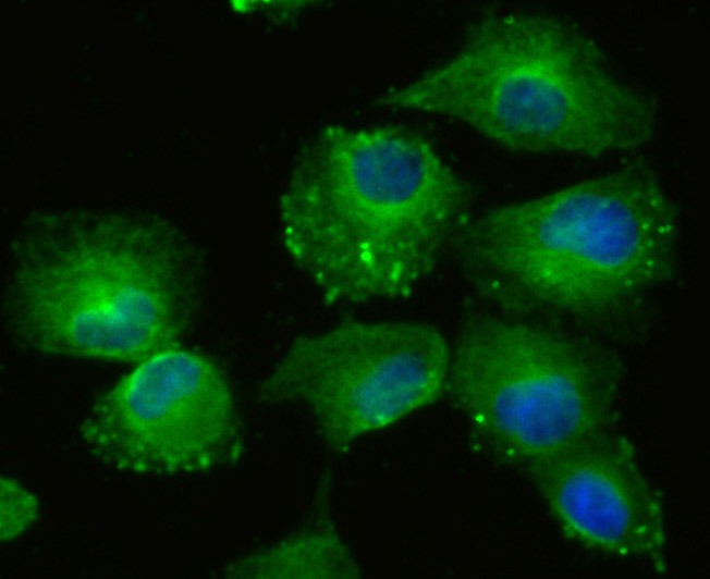Anti-LOXL2 Antibody (5D796)