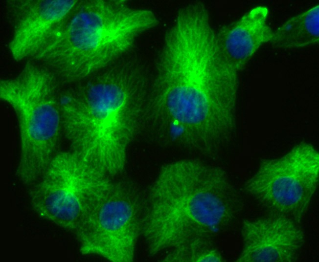 Anti-LOXL2 Antibody (5D796)