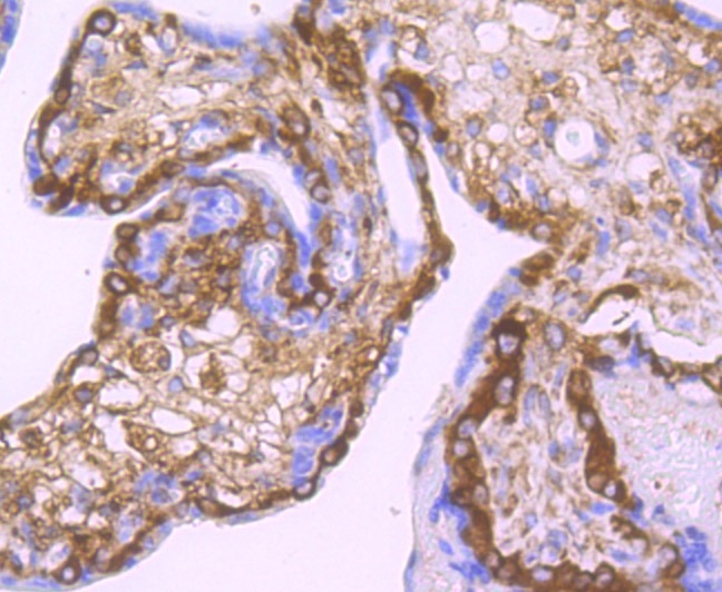 Anti-LOXL2 Antibody (5D796)