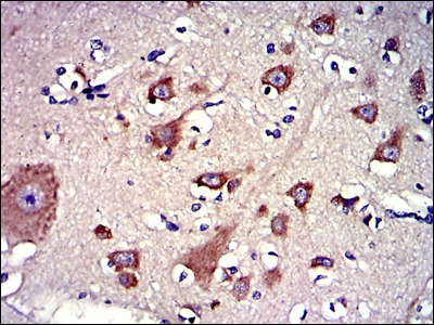 Anti-BPIFB1 Antibody (7V287)