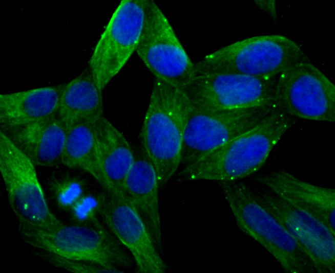 Anti-LOX Antibody (2A200)