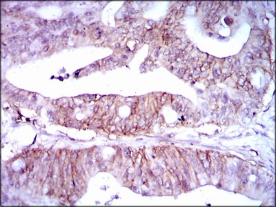 Anti-LPA Antibody (1M439)