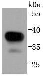 Anti-MAP2K3 Antibody (1S917)