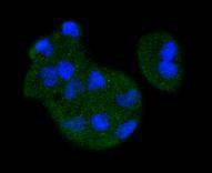 Anti-MAP2K3 Antibody (1S917)