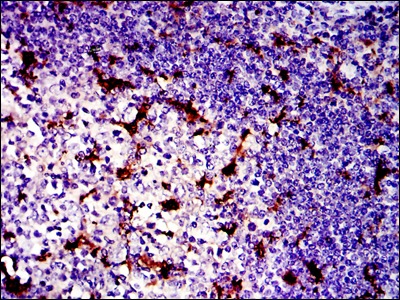 Anti-BPIFB1 Antibody (7V287)