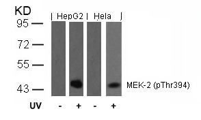 Anti-Phospho-MEK2 (Thr394) Polyclonal Antibody