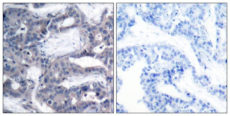 Anti-Phospho-MEK2 (Thr394) Polyclonal Antibody
