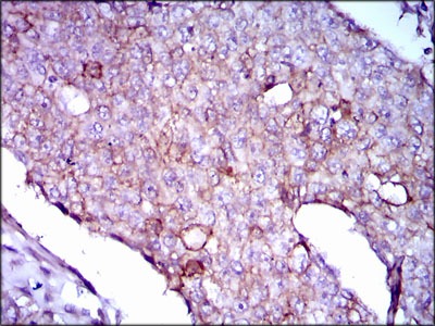 Anti-LPA Antibody (1M439)