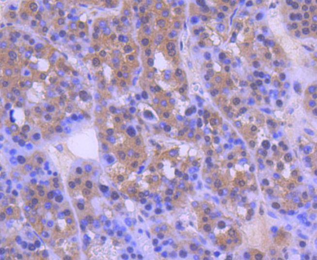 Anti-MEK2 Antibody (9Y802)
