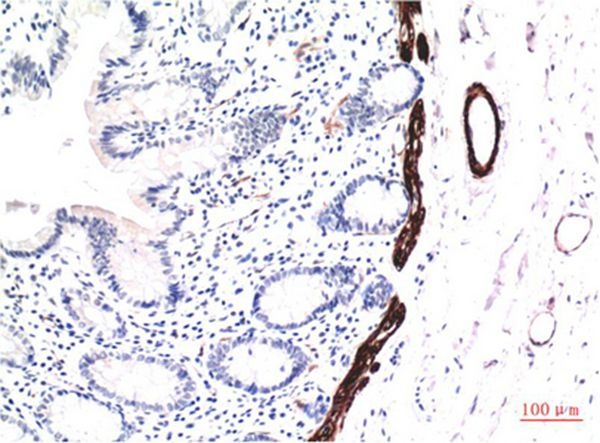 Anti-ACTA1 Antibody (5P964)