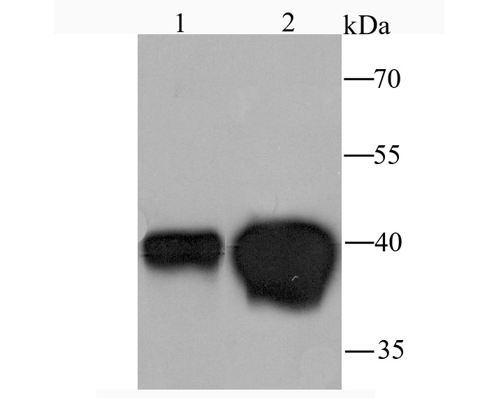 Anti-MVP Antibody (8H895)