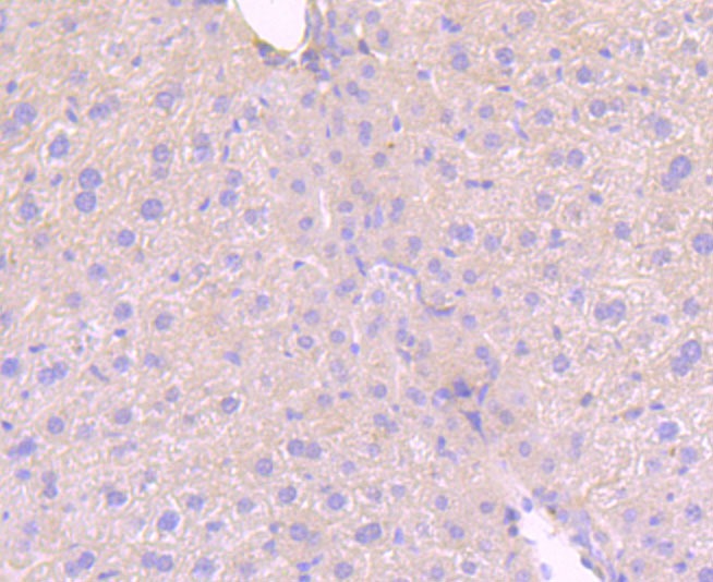 Anti-Phospho-MLKL (S345) Antibody (6R72)