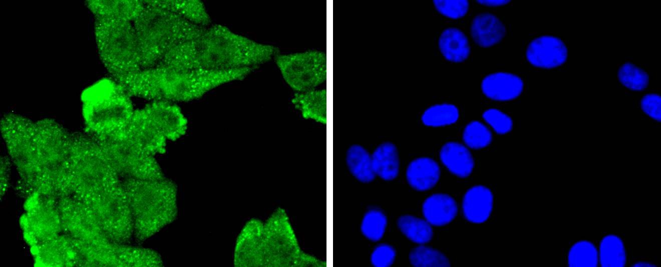 Anti-MLH1 Antibody (9P46)