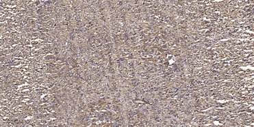 Anti-Phospho-MLKL (S358) Polyclonal Antibody