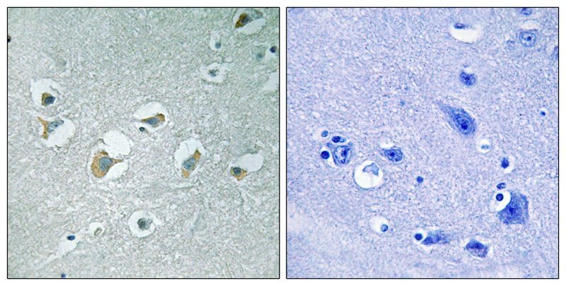Anti-Phospho-MLK1/2 (Thr312/266) Polyclonal Antibody