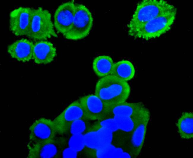 Anti-mGluR2 Antibody (4I792)