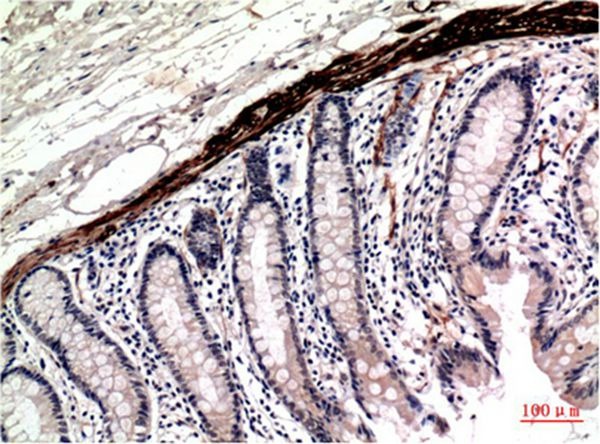 Anti-ACTA1 Antibody (5V392)