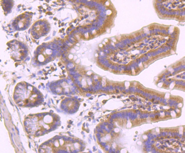 Anti-Phospho-MLKL (S345) Antibody (6R72)