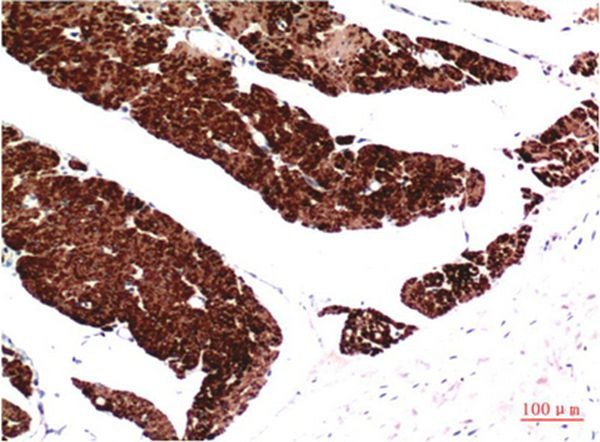 Anti-ACTA1 Antibody (5P964)