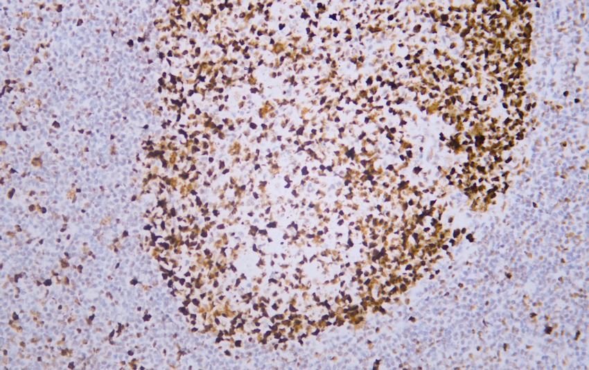 Anti-MSH6 Antibody (9T577)