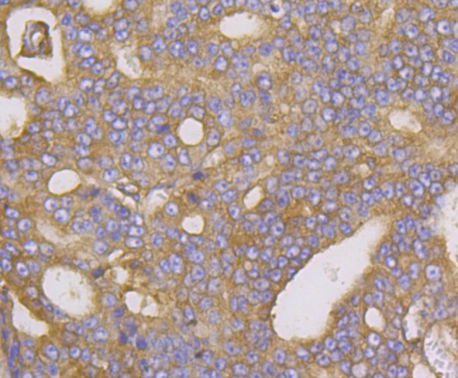Anti-METAP2 Antibody (2D279)