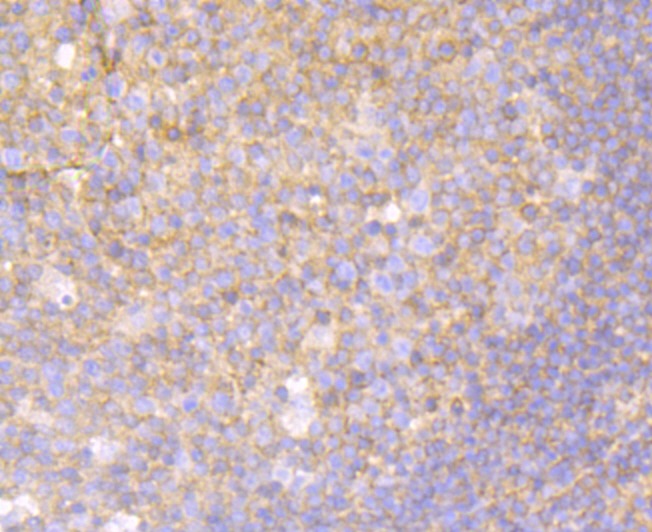 Anti-MGEA5 Antibody (9D447)