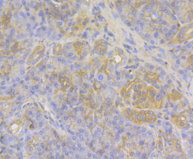 Anti-MGEA5 Antibody (9D447)