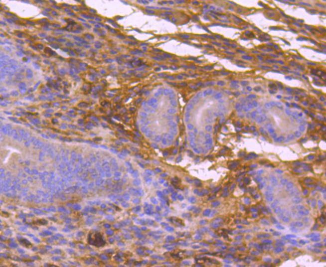 Anti-MAP3K3 Antibody (2Q519)