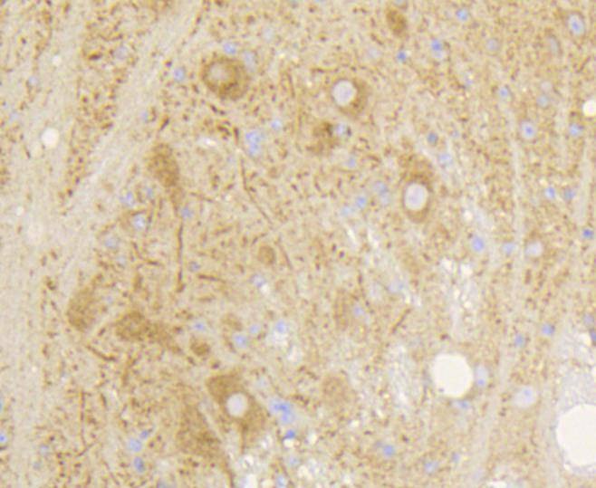 Anti-GRM5 Antibody (8K741)