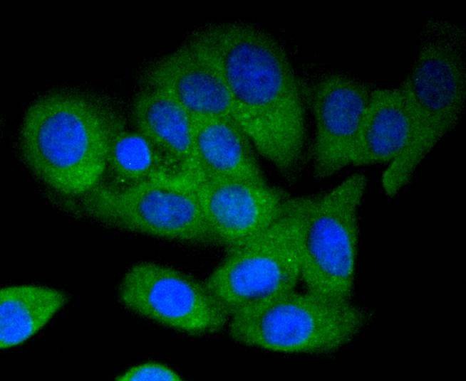 Anti-MAP3K3 Antibody (2Q519)
