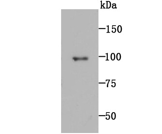Anti-MMP-9 Antibody (5C993)