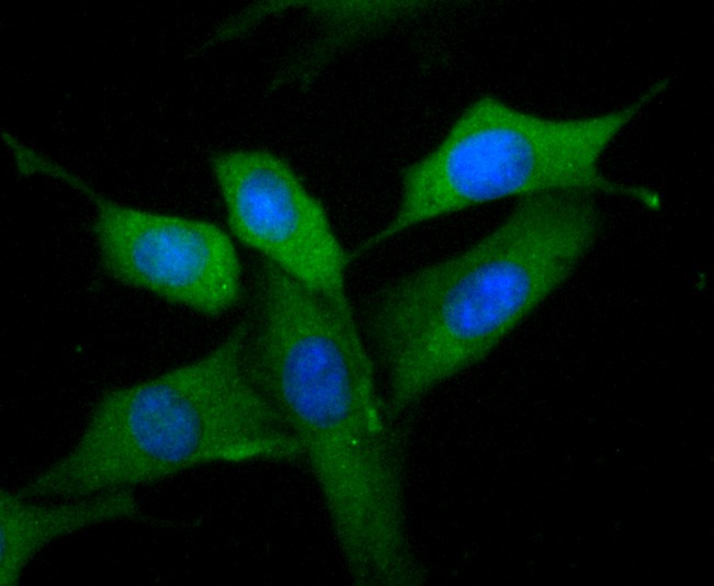 Anti-MMP-9 Antibody (5C993)