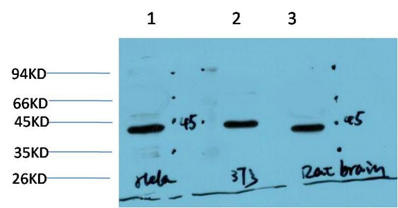 Anti-ACTA1 Antibody (6X341)