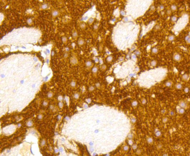 Anti-GRM5 Antibody (8K741)