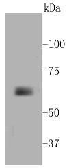 Anti-MMP-14 Antibody (7I45)