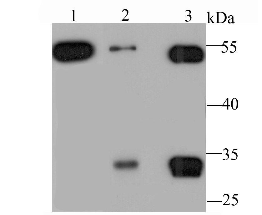 Anti-MMP-3 Antibody (6H498)