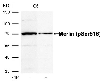 Anti-Phospho-Merlin (Ser518) Polyclonal Antibody 2