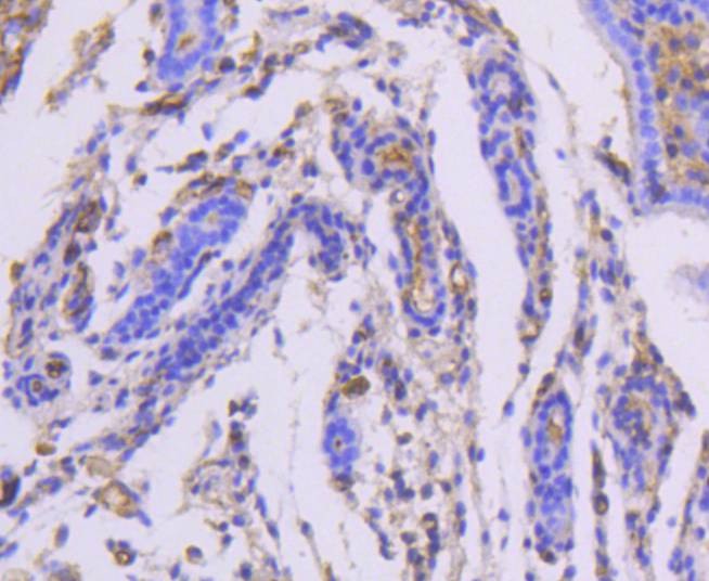 Anti-Moesin Antibody (2Z70)
