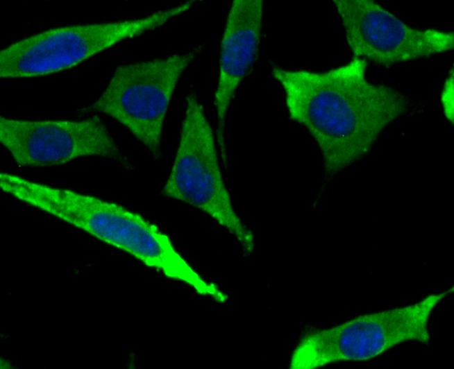 Anti-METAP2 Antibody (2D279)