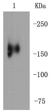 Anti-Mer Antibody (1I498)